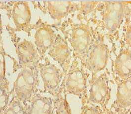 CCDC94 Polyclonal Antibody