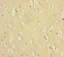 FANCD2 Polyclonal Antibody (20 µl)