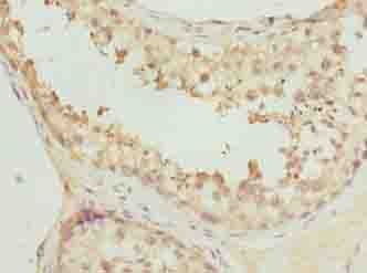 PCED1A Polyclonal Antibody