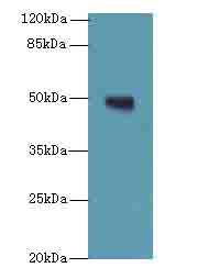 TUBB1 Polyclonal Antibody