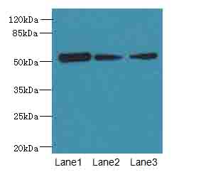 ARMT1 Polyclonal Antibody