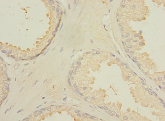 CXorf21 Polyclonal Antibody
