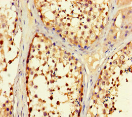 TRIM36 Polyclonal Antibody