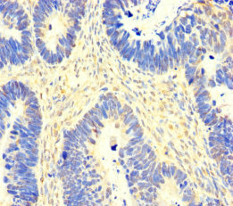 SACM1L Polyclonal Antibody
