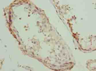 PLEKHJ1 Polyclonal Antibody