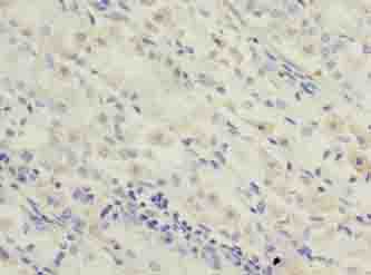 OXSM Polyclonal Antibody