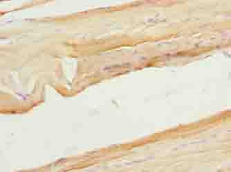 XPR1 Polyclonal Antibody