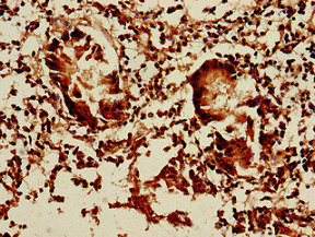 DCTN5 Polyclonal Antibody