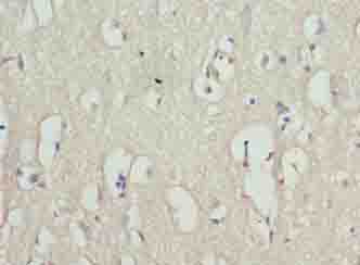 RHPN1-AS1 Polyclonal Antibody