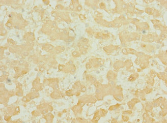 TEKT3 Polyclonal Antibody