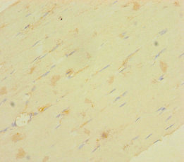 LRRC19 Polyclonal Antibody