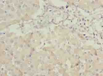 ANKRA2 Polyclonal Antibody (50 µl)