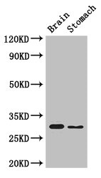 COPS7B Polyclonal Antibody (100 µl)