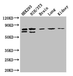 NUP85 Polyclonal Antibody