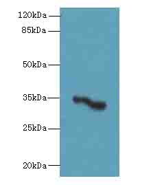 OR2H1 Polyclonal Antibody