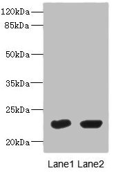 UBE2T Polyclonal Antibody