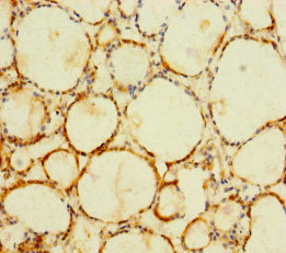 C1orf112 Polyclonal Antibody