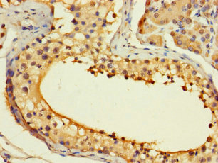 Immunohistochemistry of paraffin-embedded human testis tissue using ASF1B Polyclonal Antibody at dilution of 1:100