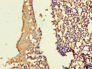 Immunohistochemistry of paraffin-embedded human tonsil tissue using ASF1B Polyclonal Antibody at dilution of 1:100
