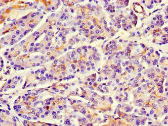 MAP10 Polyclonal Antibody