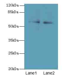 TRIM55 Polyclonal Antibody