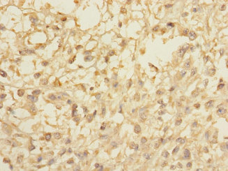 CCDC113 Polyclonal Antibody (50 µl)