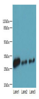 NIT2 Polyclonal Antibody