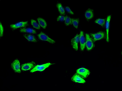 ELOVL5 Polyclonal Antibody