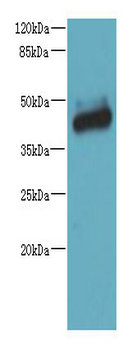 ST6GALNAC2 Polyclonal Antibody