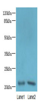 C15orf57 Polyclonal Antibody