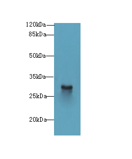 Snrnp35 Polyclonal Antibody