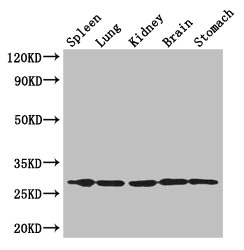 RTP3 Polyclonal Antibody