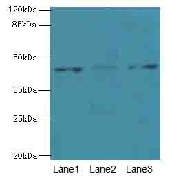 DSCC1 Polyclonal Antibody