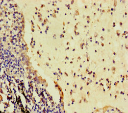 RSPO3 Polyclonal Antibody
