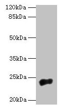 NACA2 Polyclonal Antibody