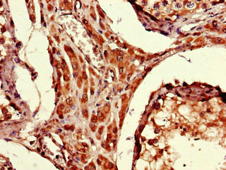 ARRDC1-AS1 Polyclonal Antibody