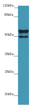 DHX35 Polyclonal Antibody
