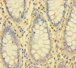 IL1RL2 Polyclonal Antibody