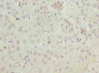 ELOVL2 Polyclonal Antibody