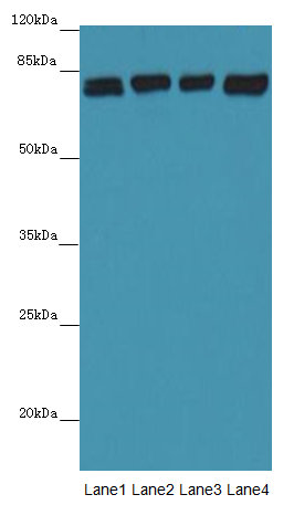 Western blot<br />All Lanes: DHX35 Antibody at 12