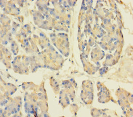 APPL1 Polyclonal Antibody (50 µl)