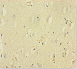 Immunohistochemistry of paraffin-embedded human brain tissue using GABRQ Polyclonal Antibody at dilution 1:100