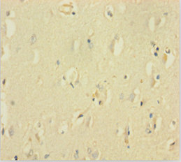 GABRQ Polyclonal Antibody