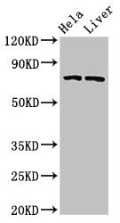 ACSL5 Polyclonal Antibody