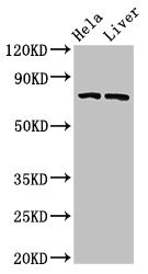 ACSL5 Polyclonal Antibody (20 µl)