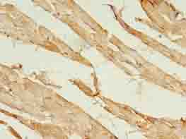 Immunohistochemistry of paraffin-embedded human skeletal muscle tissue using ACSL5 Polyclonal Antibody at dilution of 1:100