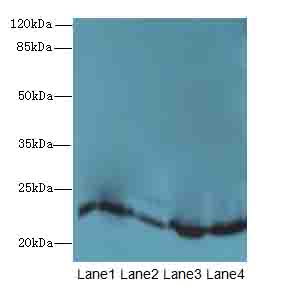 HPCAL4 Polyclonal Antibody