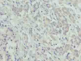 ATXN7L1 Polyclonal Antibody