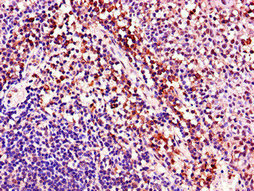 Immunohistochemistry of paraffin-embedded human tonsil tissue using ACAD8 Polyclonal Antibody at dilution of 1:100