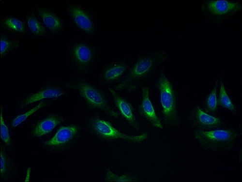 SLC17A4 Polyclonal Antibody